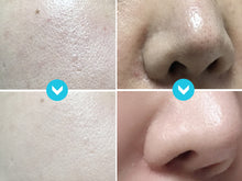 Load image into Gallery viewer, Labelle - Ultrasonic and Galvanic Skin Care Device (Made in Korea)